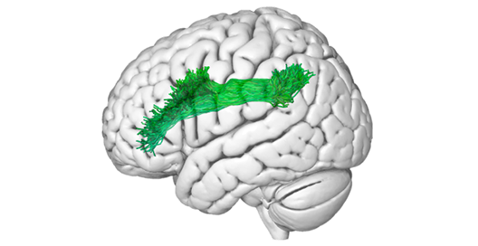 full_tractography 1