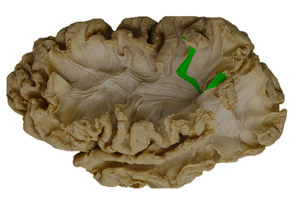 sub-02_epo-01_ref-00_lateral